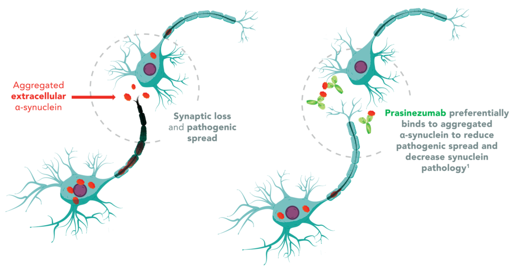 Parkinson's Disease