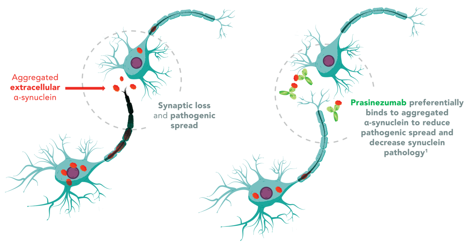 Parkinson's Disease